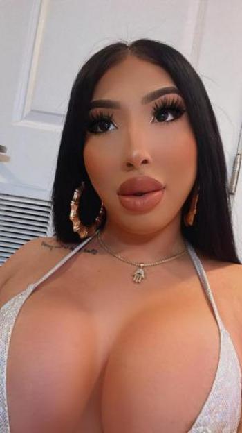 9567075093, transgender escort, Mcallen